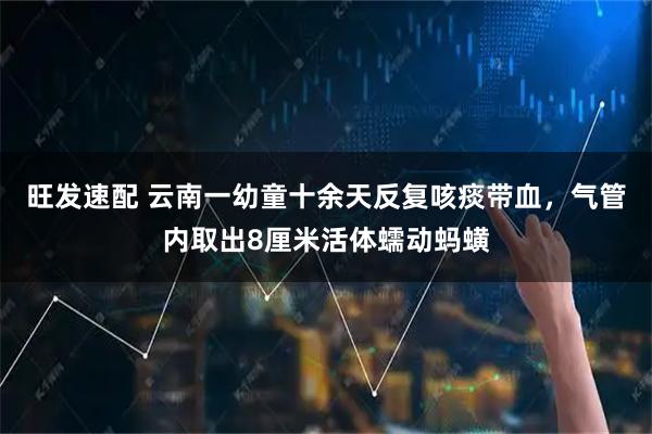 旺发速配 云南一幼童十余天反复咳痰带血，气管内取出8厘米活体蠕动蚂蟥